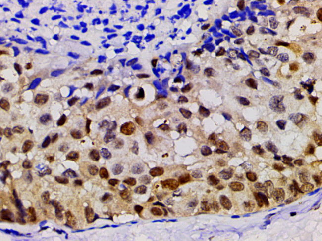 Phospho-LIMK1 (Thr508) Antibody in Immunohistochemistry (Paraffin) (IHC (P))