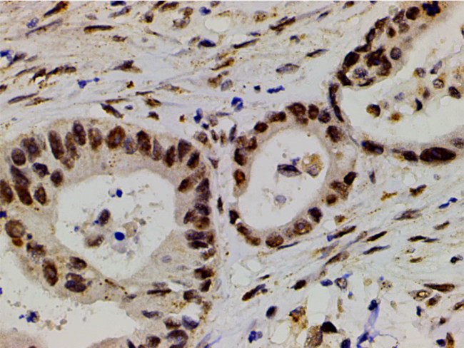 Phospho-LIMK1 (Thr508) Antibody in Immunohistochemistry (Paraffin) (IHC (P))