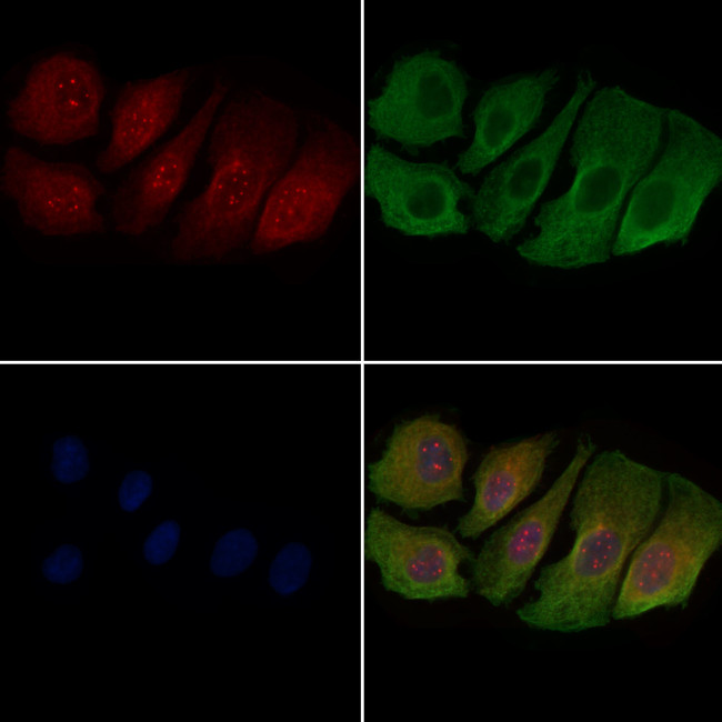 Phospho-Ataxin 1 (Ser775) Antibody in Immunocytochemistry (ICC/IF)