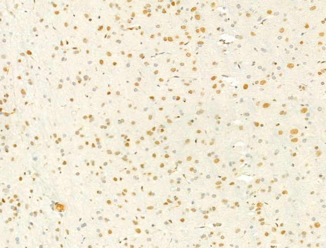 Phospho-Ataxin 1 (Ser775) Antibody in Immunohistochemistry (Paraffin) (IHC (P))