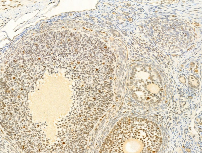 Phospho-Ataxin 1 (Ser775) Antibody in Immunohistochemistry (Paraffin) (IHC (P))