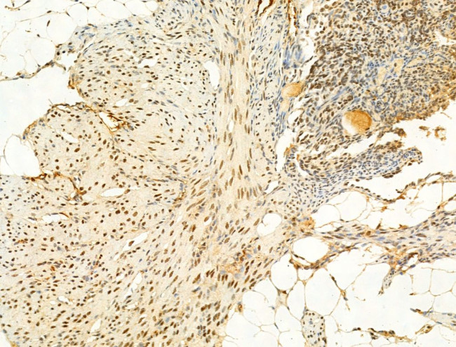 Phospho-Ataxin 1 (Ser775) Antibody in Immunohistochemistry (Paraffin) (IHC (P))