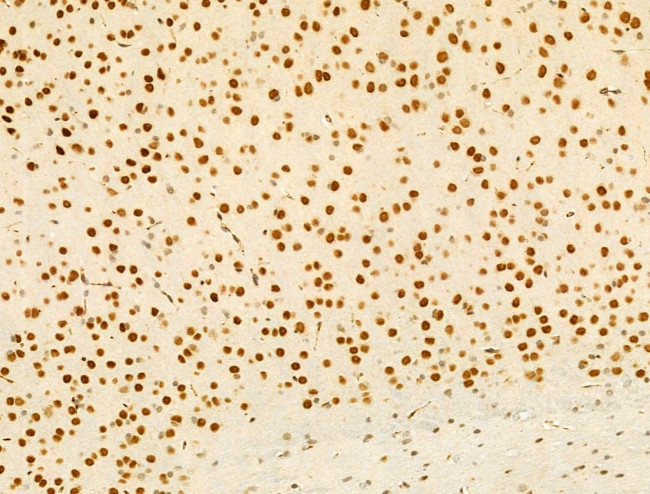 Phospho-Ataxin 1 (Ser775) Antibody in Immunohistochemistry (Paraffin) (IHC (P))