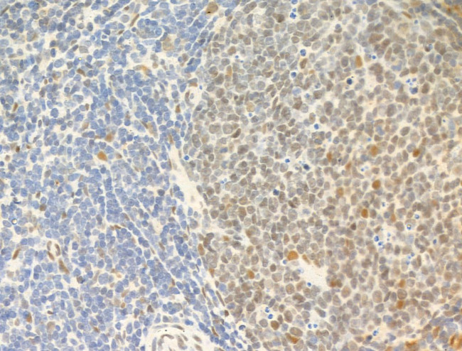 Phospho-Ataxin 1 (Ser775) Antibody in Immunohistochemistry (Paraffin) (IHC (P))