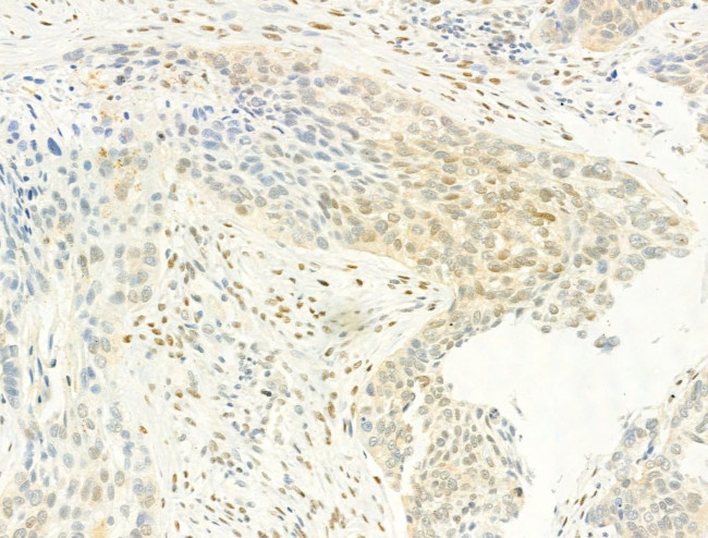 Phospho-Ataxin 1 (Ser775) Antibody in Immunohistochemistry (Paraffin) (IHC (P))