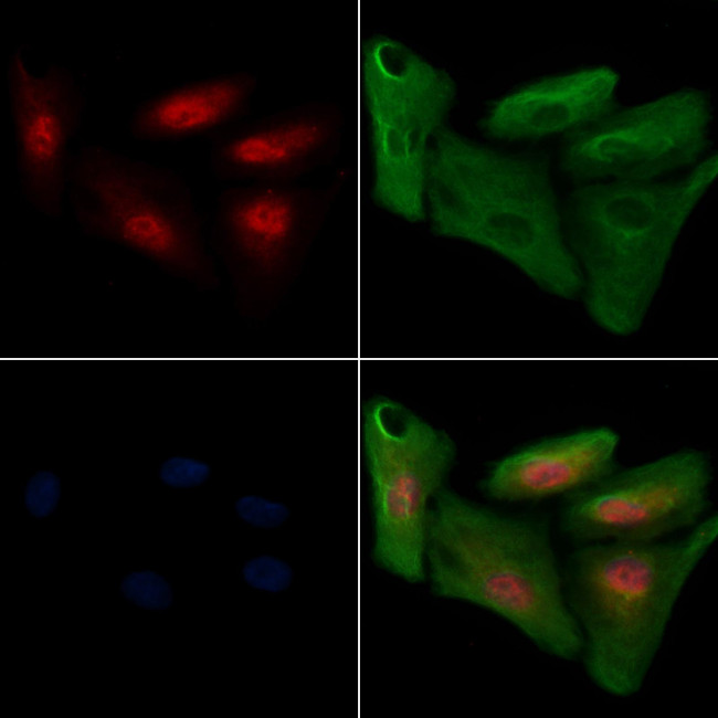 Phospho-IRF3 (Ser386) Antibody in Immunocytochemistry (ICC/IF)