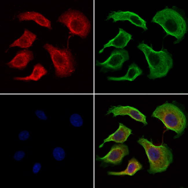 Phospho-IRF3 (Ser386) Antibody in Immunocytochemistry (ICC/IF)