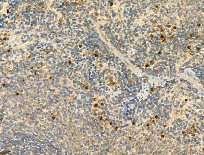 Phospho-IRF3 (Ser386) Antibody in Immunohistochemistry (Paraffin) (IHC (P))