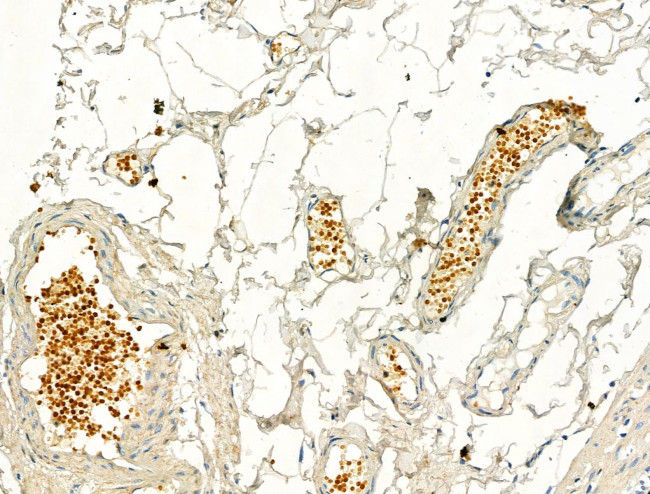 Phospho-IRF3 (Ser386) Antibody in Immunohistochemistry (Paraffin) (IHC (P))