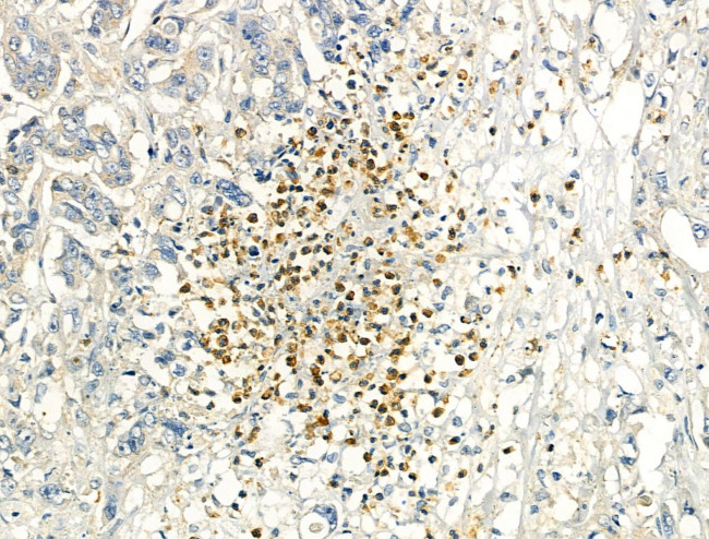 Phospho-IRF3 (Ser386) Antibody in Immunohistochemistry (Paraffin) (IHC (P))