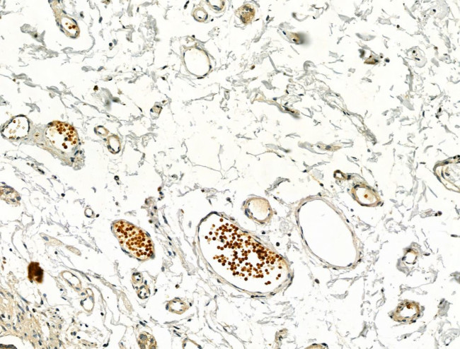 Phospho-IRF3 (Ser386) Antibody in Immunohistochemistry (Paraffin) (IHC (P))