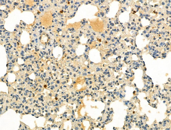 Phospho-IRF3 (Ser386) Antibody in Immunohistochemistry (Paraffin) (IHC (P))