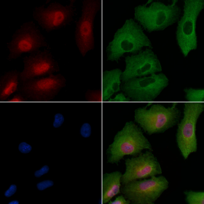 Phospho-FGFR1/FGFR2 (Tyr463, Tyr466) Antibody in Immunocytochemistry (ICC/IF)