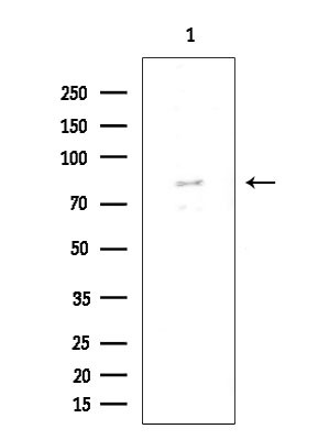 FOXP1 Antibody in Western Blot (WB)