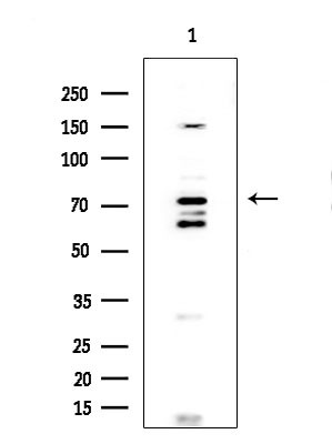 FOXP1 Antibody in Western Blot (WB)