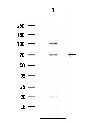 FOXP1 Antibody in Western Blot (WB)