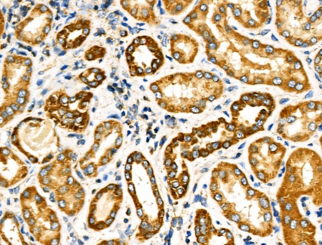 NDUFA4 Antibody in Immunohistochemistry (Paraffin) (IHC (P))