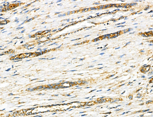 NDUFA4 Antibody in Immunohistochemistry (Paraffin) (IHC (P))