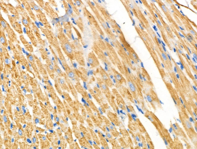 NDUFA4 Antibody in Immunohistochemistry (Paraffin) (IHC (P))