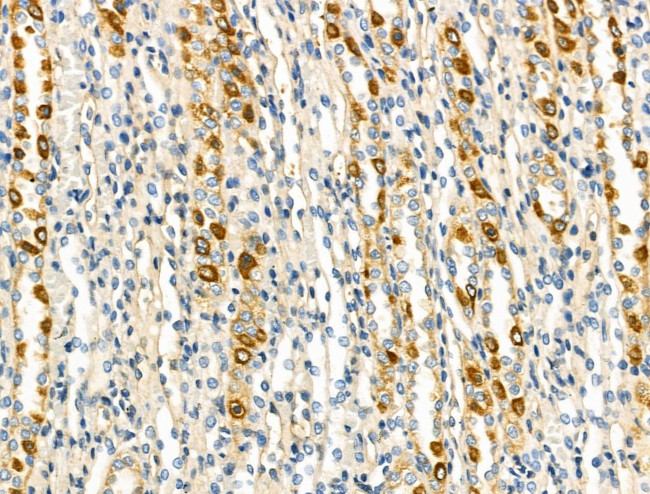 NDUFA4 Antibody in Immunohistochemistry (Paraffin) (IHC (P))