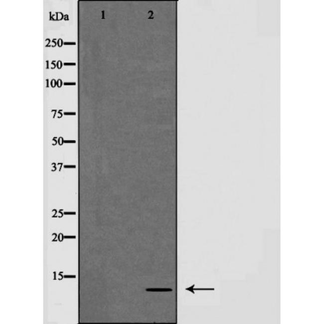 NDUFA4 Antibody in Western Blot (WB)