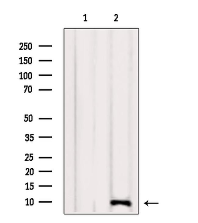 NDUFA4 Antibody in Western Blot (WB)