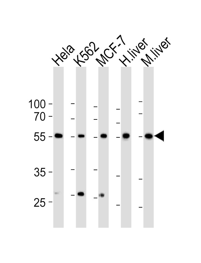 BMPR1A Antibody in Western Blot (WB)