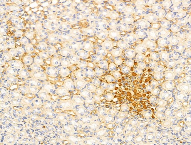 ITGB5 Antibody in Immunohistochemistry (Paraffin) (IHC (P))