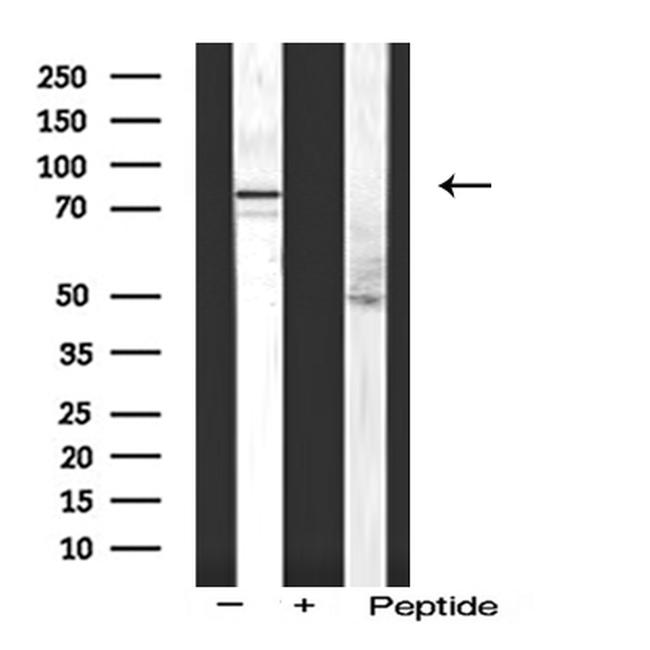 ITGB5 Antibody in Western Blot (WB)