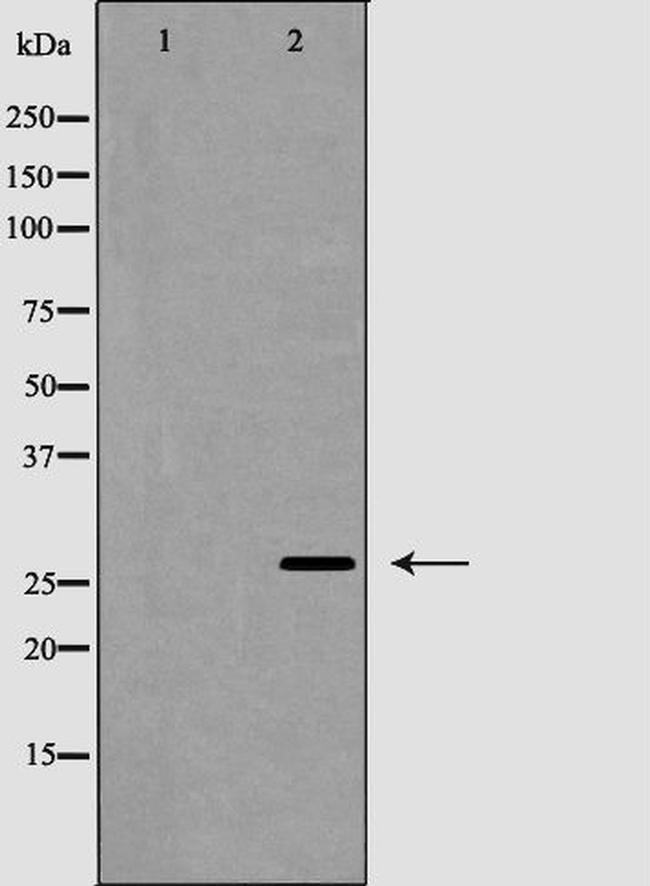 APRIL Antibody in Western Blot (WB)