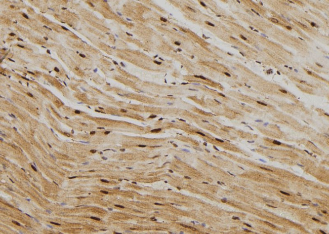 HSP70 Antibody in Immunohistochemistry (Paraffin) (IHC (P))