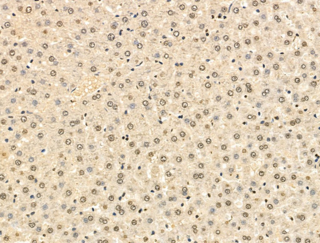 HSP70 Antibody in Immunohistochemistry (Paraffin) (IHC (P))