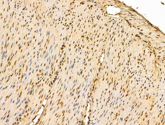 HSP70 Antibody in Immunohistochemistry (Paraffin) (IHC (P))