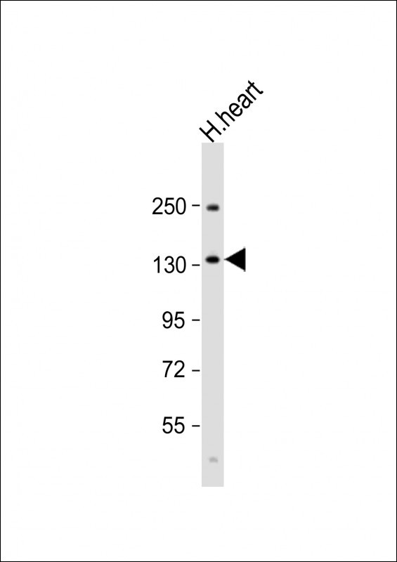 BMPR2 Antibody in Western Blot (WB)