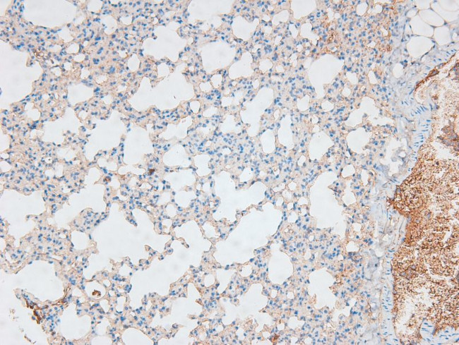 Phospho-Caveolin 2 (Ser23) Antibody in Immunohistochemistry (Paraffin) (IHC (P))