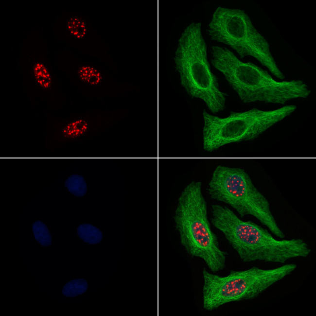 Phospho-Rb (Thr252) Antibody in Immunocytochemistry (ICC/IF)