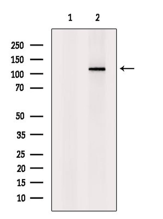 Phospho-Rb (Thr252) Antibody in Western Blot (WB)