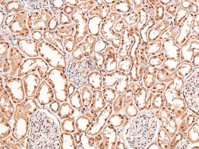 Phospho-BRCA1 (Ser1497) Antibody in Immunohistochemistry (Paraffin) (IHC (P))