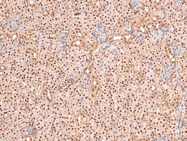 Phospho-BRCA1 (Ser1497) Antibody in Immunohistochemistry (Paraffin) (IHC (P))