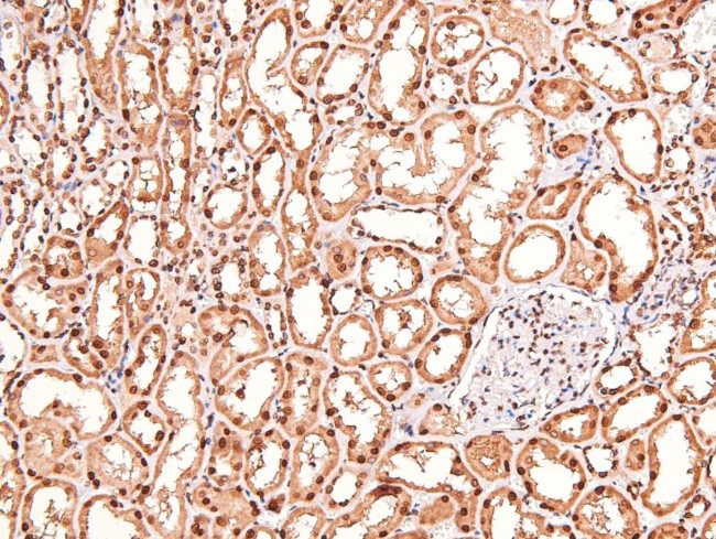 Phospho-Claudin 4 (Tyr208) Antibody in Immunohistochemistry (Paraffin) (IHC (P))