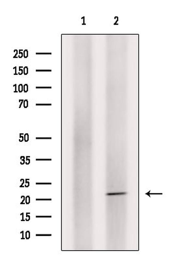 Phospho-Claudin 4 (Tyr208) Antibody in Western Blot (WB)