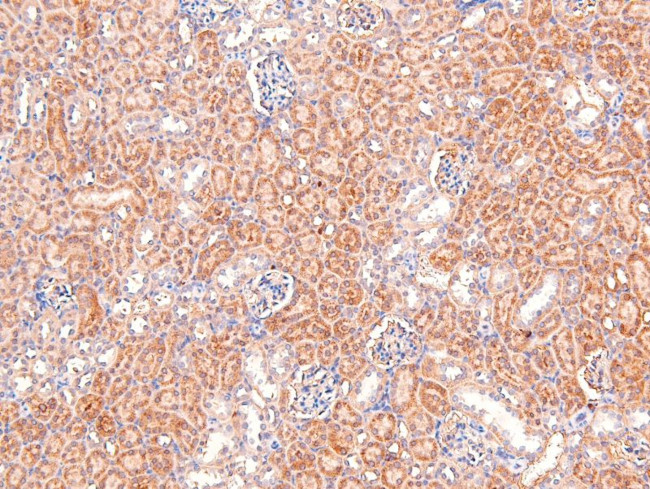 Phospho-delta Catenin (Tyr257) Antibody in Immunohistochemistry (Paraffin) (IHC (P))