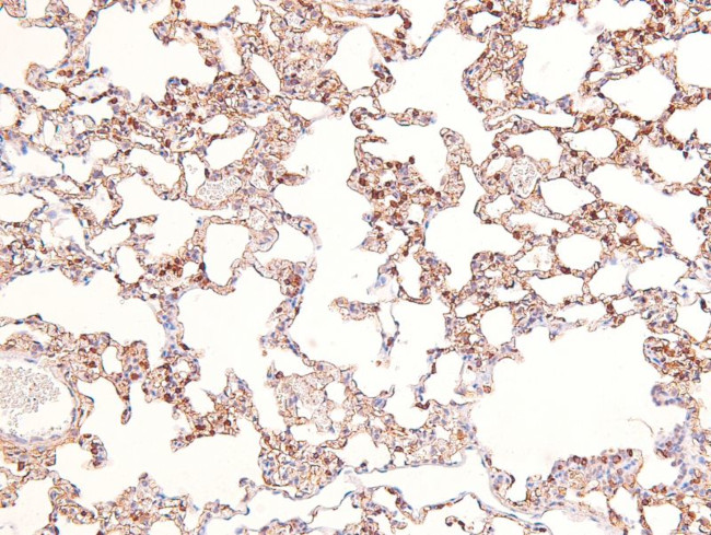 Phospho-delta Catenin (Tyr257) Antibody in Immunohistochemistry (Paraffin) (IHC (P))