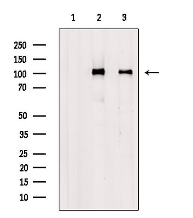 Phospho-delta Catenin (Tyr257) Antibody in Western Blot (WB)