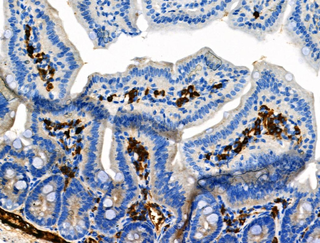 Phospho-delta Catenin (Tyr904) Antibody in Immunohistochemistry (Paraffin) (IHC (P))