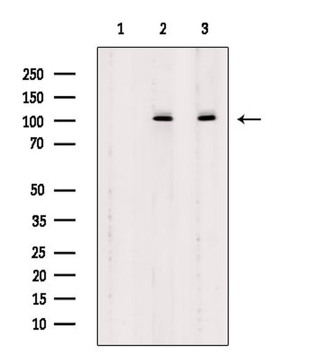 Phospho-delta Catenin (Tyr904) Antibody in Western Blot (WB)