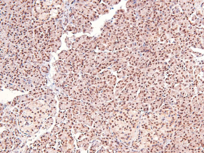 Phospho-CUX1 (Ser1215) Antibody in Immunohistochemistry (Paraffin) (IHC (P))