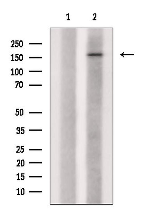 Phospho-CUX1 (Ser1215) Antibody in Western Blot (WB)