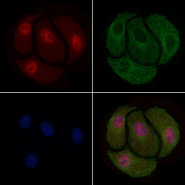 Phospho-Cyclin B1 (Ser128) Antibody in Immunocytochemistry (ICC/IF)