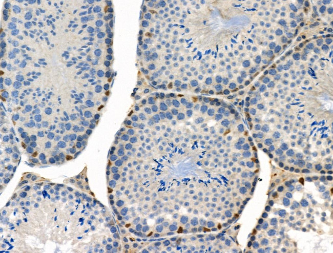 Phospho-Cyclin B1 (Ser128) Antibody in Immunohistochemistry (Paraffin) (IHC (P))